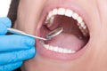 Dentist inspecting teeth using mirror