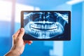 a dentist looking at a dental x-ray Royalty Free Stock Photo