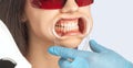The dentist makes a teeth whitening procedure in the clinic to a young beautiful woman. A healthy smile