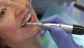 Dentist moves prophy cup across upper incisors