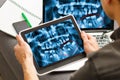 Dentist Office-Digital tablet with a patients x-rays Royalty Free Stock Photo