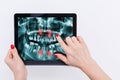 Dentist Office-Digital tablet with a patients x-rays Royalty Free Stock Photo