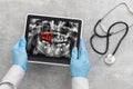 Dentist Office-Digital tablet with a patients x-rays Royalty Free Stock Photo