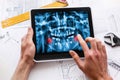 Dentist Office-Digital tablet with a patients x-rays Royalty Free Stock Photo