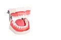 Dentist orthodontic teeth model with focus on lower teeth