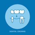 Dentist, orthodontics line icon. Dental crown, tooth treatment sign, medical elements. Health care thin linear symbol