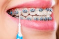 Woman brushing teeth with braces using brush Royalty Free Stock Photo