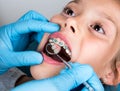 Dentist, Orthodontist examining a little girl patient`s teeth