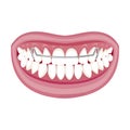 Dentist, orthodontist. Vector illustration. Braces on teeth. open mouth.