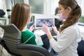 Dentist and patient examining x-ray picture in dental clinic. Doctor showing thumbs up to patient. Dentistry