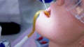 Dentist pours water on woman teeth use saliva ejector during cure, closeup view.