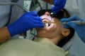 Dentist is preparing woman& x27;s teeth for installing ceramic veneers using a drill.