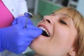 Dentist puts dental veneers patient and correction of teeth