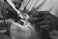 The dentist removes tartar using ultrasound, the patient at the dentist. Retractor for isolation of lips and gums