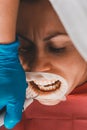 At the dentist`s appointment, tartar removal, use of ultrasound, patient and dentist. Retractor for isolation of lips and gums Royalty Free Stock Photo