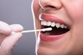 Dentist`s Hand Taking Saliva Test From Woman`s Mouth