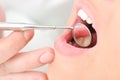 Dentists teeth checkup Royalty Free Stock Photo
