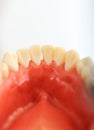 Dentists teeth checkup, series of related photos