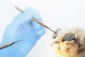 Dentist's tools in dentist hands with blue gloves and big wisdom Royalty Free Stock Photo