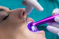 Dentist setting fissure sealant with led curing lamp on patient.