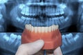 Dentist show lower dental arch over x-ray teeth Royalty Free Stock Photo