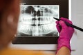 Dentist show patients teeth on xray Royalty Free Stock Photo