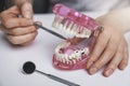 Dentist showing dental caries tooth decay on jaw model