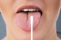 Taking Saliva Test From Woman`s Mouth