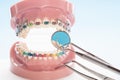 Dentist tools and orthodontic model.