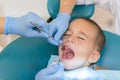 Dentist is treating a boy's teeth. Dentist examining boy's teeth in clinic. A small patient in the dental chair smiles. Dantist