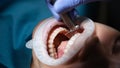 Dentist treating patient teeth with drill in dental clinic closeup Royalty Free Stock Photo