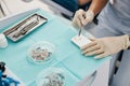 Dentist using dental spatula for creating dental filling