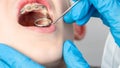 Dentist using an instrument to visualize the teeth of a child patient Royalty Free Stock Photo