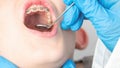 Dentist using an instrument to visualize the teeth of a child patient