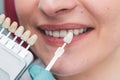 Dentist using shade guide at beautiful smile of female mouth to check the process of teeth whitening or shades of the implants, Royalty Free Stock Photo