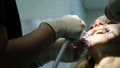 Dentist washes the orthodontic blue gel from the woman`s teeth into the fixator before installing the bracket system