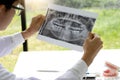 dentist work on the table with Denture and teeth x-ray Royalty Free Stock Photo