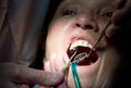 Dentist working on teeth Royalty Free Stock Photo