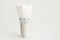 Dentistry implant clean white scheme. Generative ai design