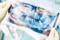 Dentistry internship diagnostic panoramic x ray Royalty Free Stock Photo