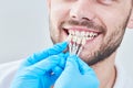 Dentistry. matching colour of the tooth enamel with whitening chart Royalty Free Stock Photo