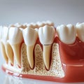 Dentistry study Artificial tooth roots in jaw, treating gum disease