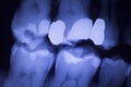 Dentists dental teeth xray