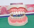 Dentoform, Dental teeth model Royalty Free Stock Photo