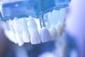 Dentsts dental tooth implant Royalty Free Stock Photo