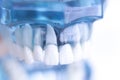 Dentsts dental tooth implant Royalty Free Stock Photo