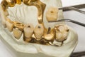 Denture (about 1950) Royalty Free Stock Photo