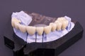 Denture Royalty Free Stock Photo