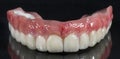 Denture, dental bridge