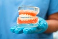 Denture, dentist holding dental teeth model to study and treat in hospital